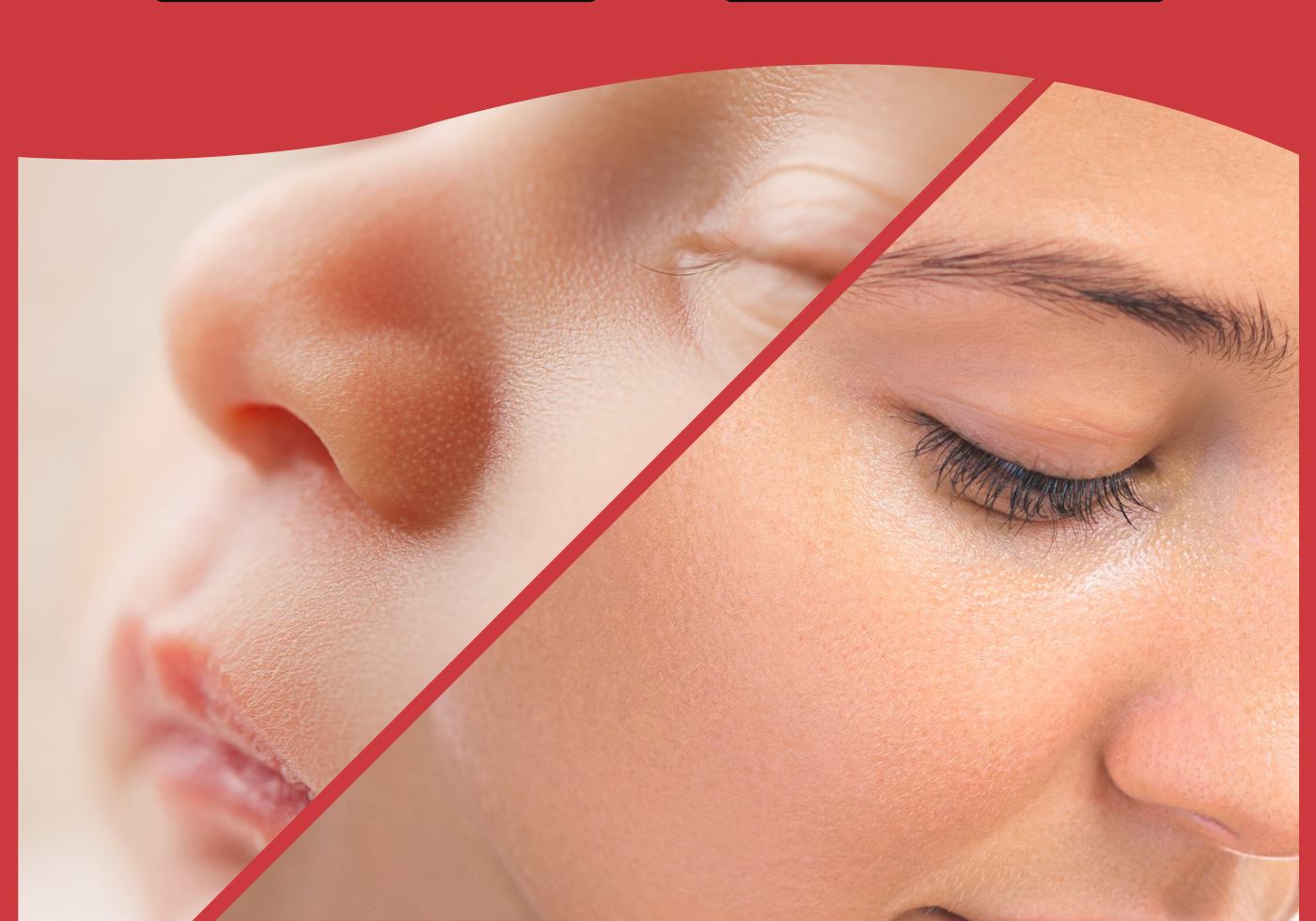 How is baby skin different from adult skin?