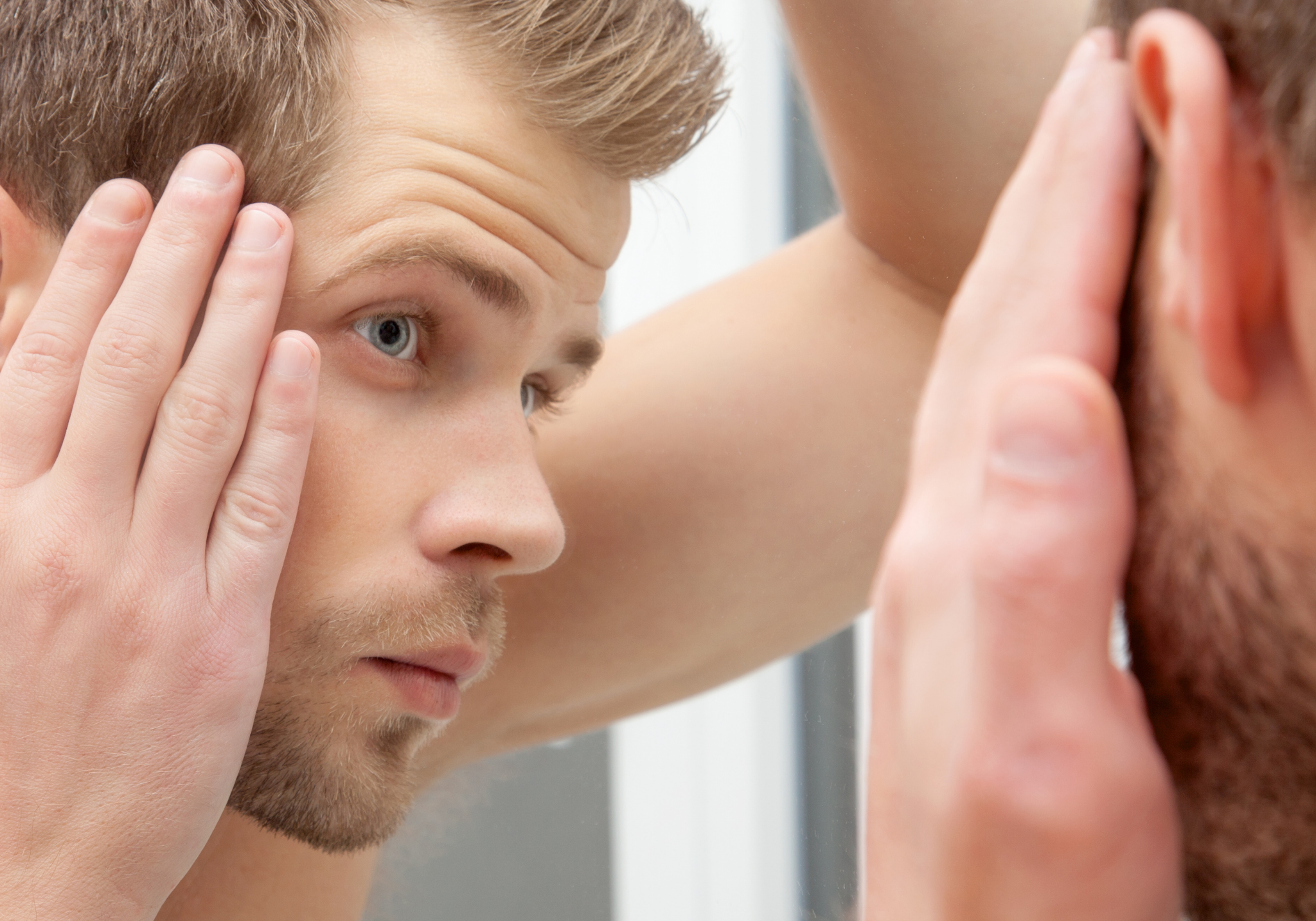 Best hair treatment for Male Pattern Hair Loss