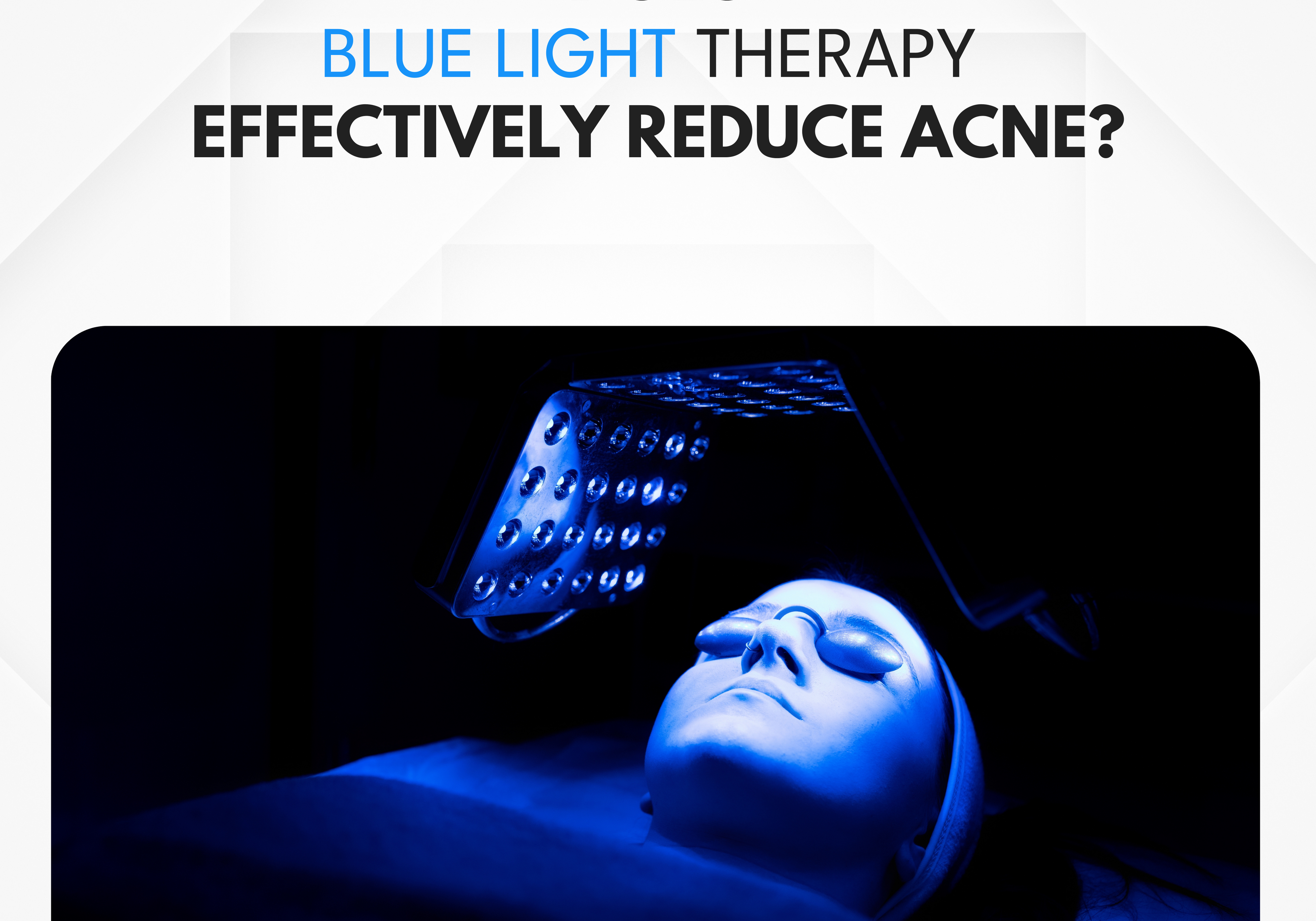 How Effective is Blue Light Therapy for Acne?