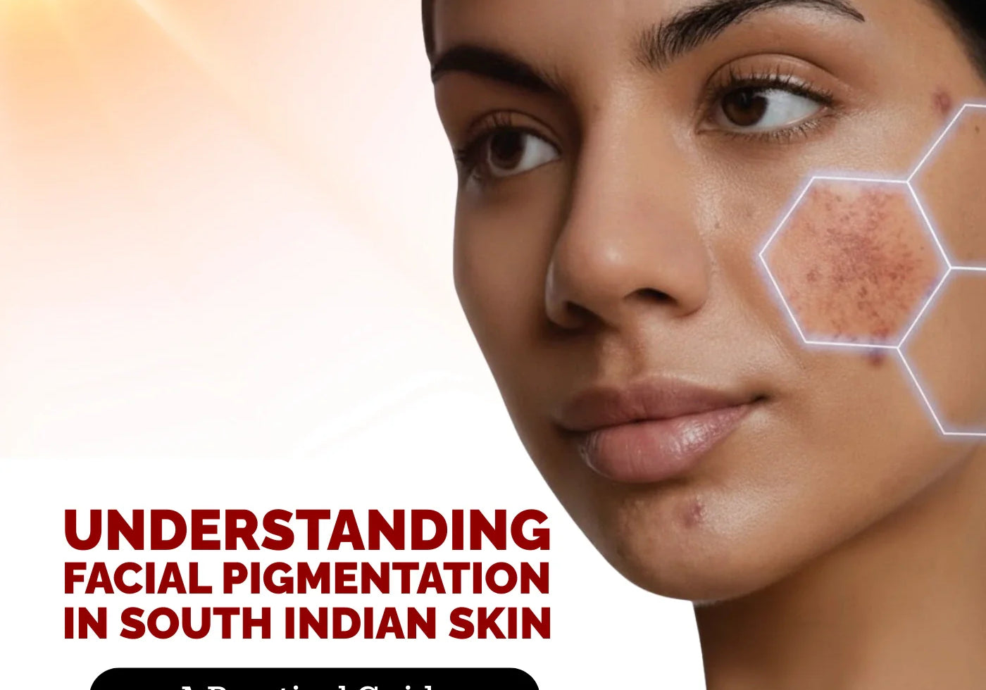 How To Prevent and Treat Facial Pigmentation in South Indian Skin?