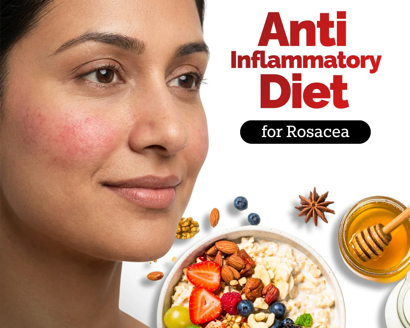 How Your Diet Impacts Rosacea: Science Backed Tips on What to Eat and Avoid