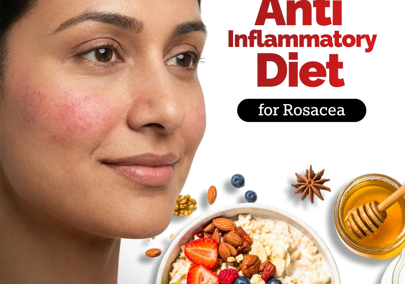 How Your Diet Impacts Rosacea: Science Backed Tips on What to Eat and Avoid