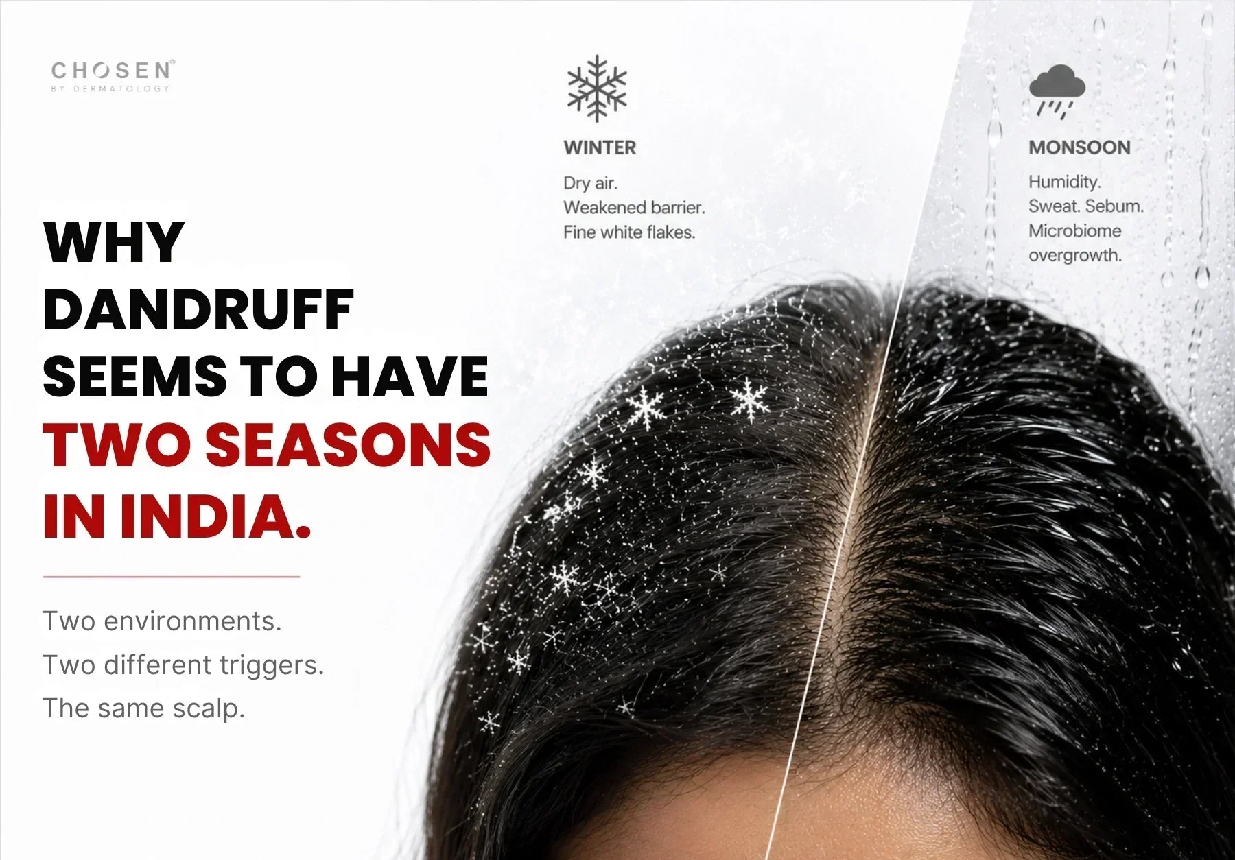 Monsoon Dandruff vs Winter Dandruff - The Seasonality Effect