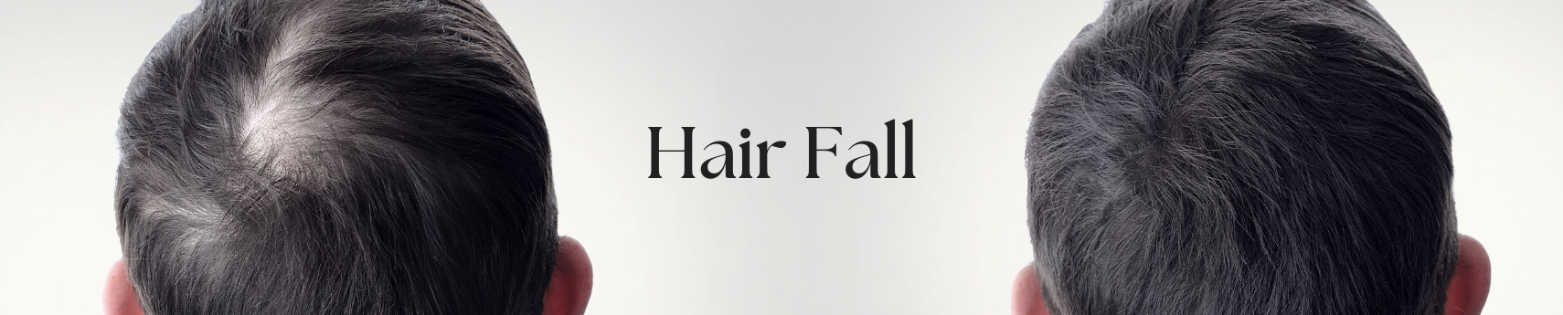 Best Hair Care Products for Male Pattern Hair Fall