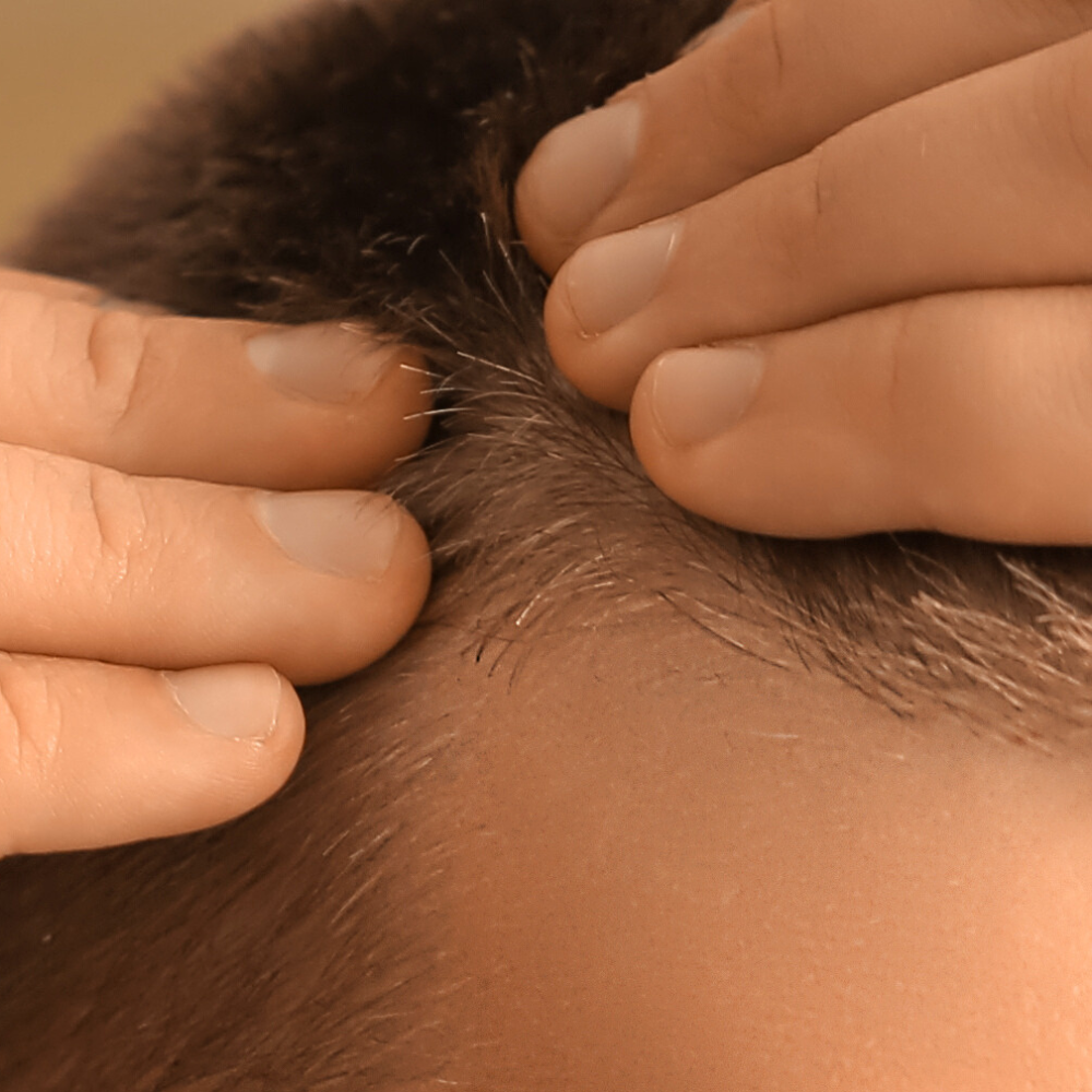 Male_Pattern_Hair_Loss_8e49f212-4955-443b-b1da-ca1285f74a1c.png