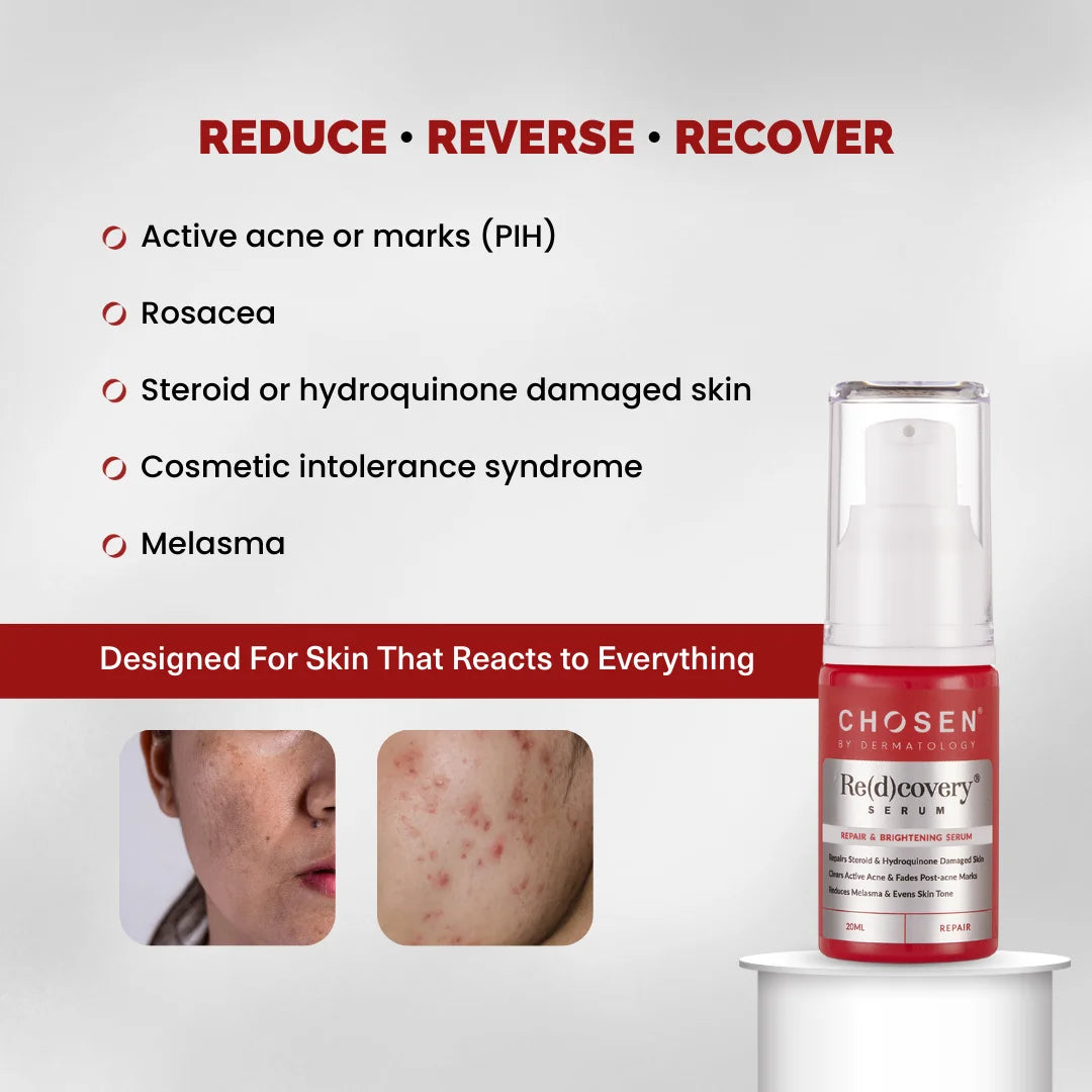 Redcovery Serum-Reduce, Reverse & Recover