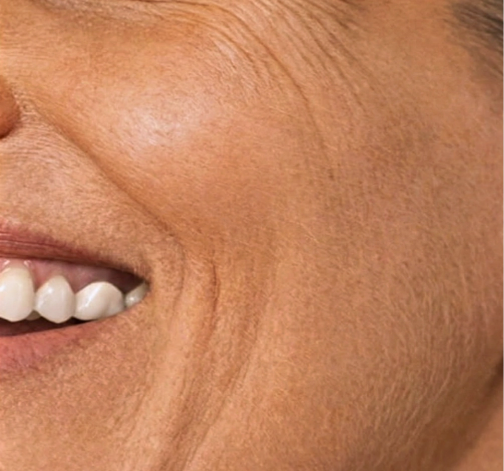 anti-aging-concern